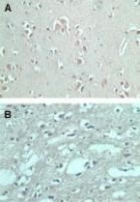 FMNL2 Antibody in Immunohistochemistry (Paraffin) (IHC (P))