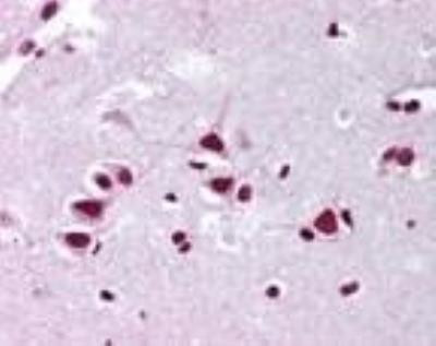 FMNL2 Antibody in Immunohistochemistry (Paraffin) (IHC (P))