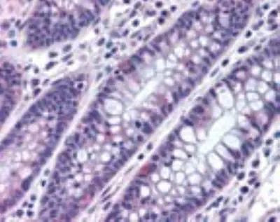 MTSS1 Antibody in Immunohistochemistry (Paraffin) (IHC (P))