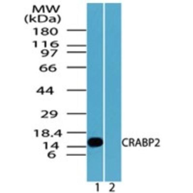 CRABP2 Antibody in Western Blot (WB)