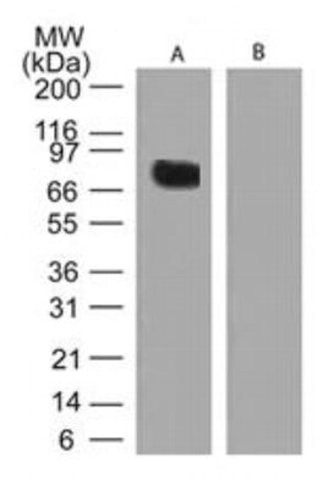 TGM2 Antibody in Western Blot (WB)