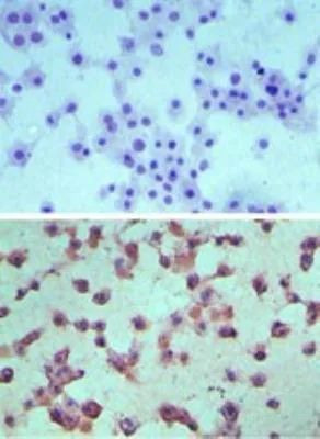 EDG6 Antibody in Immunohistochemistry (Paraffin) (IHC (P))