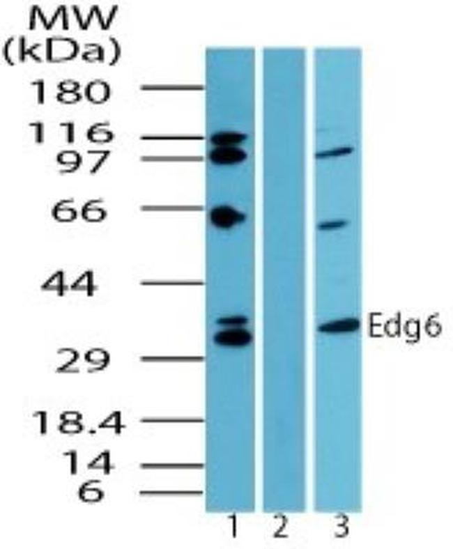 EDG6 Antibody in Western Blot (WB)