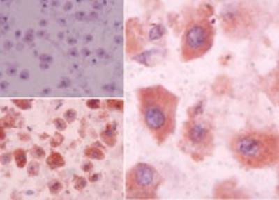 EDG3 Antibody in Immunohistochemistry (Paraffin) (IHC (P))