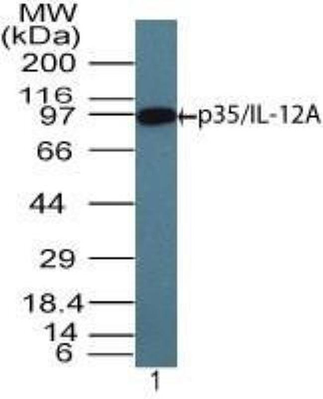 IL-12 p35 Antibody in Western Blot (WB)