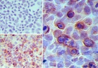 GPR35 Antibody in Immunohistochemistry (Paraffin) (IHC (P))