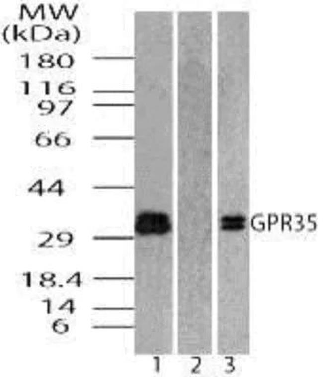 GPR35 Antibody in Western Blot (WB)