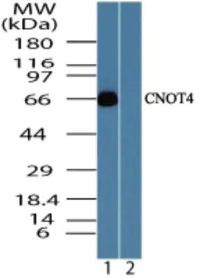 CNOT4 Antibody in Western Blot (WB)