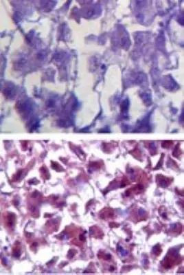 SOD1 Antibody in Immunohistochemistry (Paraffin) (IHC (P))