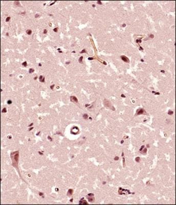 FMN2 Antibody in Immunohistochemistry (Paraffin) (IHC (P))