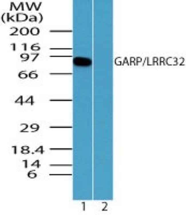 GARP Antibody in Western Blot (WB)
