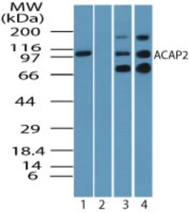 ACAP2 Antibody in Western Blot (WB)