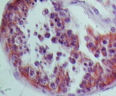 NALP9 Antibody in Immunohistochemistry (Paraffin) (IHC (P))