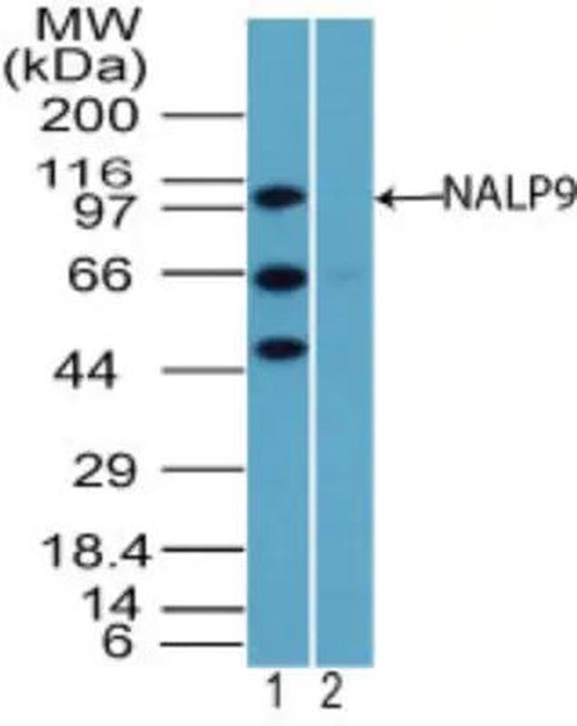 NALP9 Antibody in Western Blot (WB)