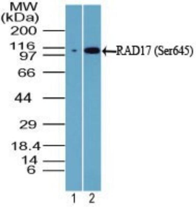 Phospho-RAD17 (Ser645) Antibody in Western Blot (WB)