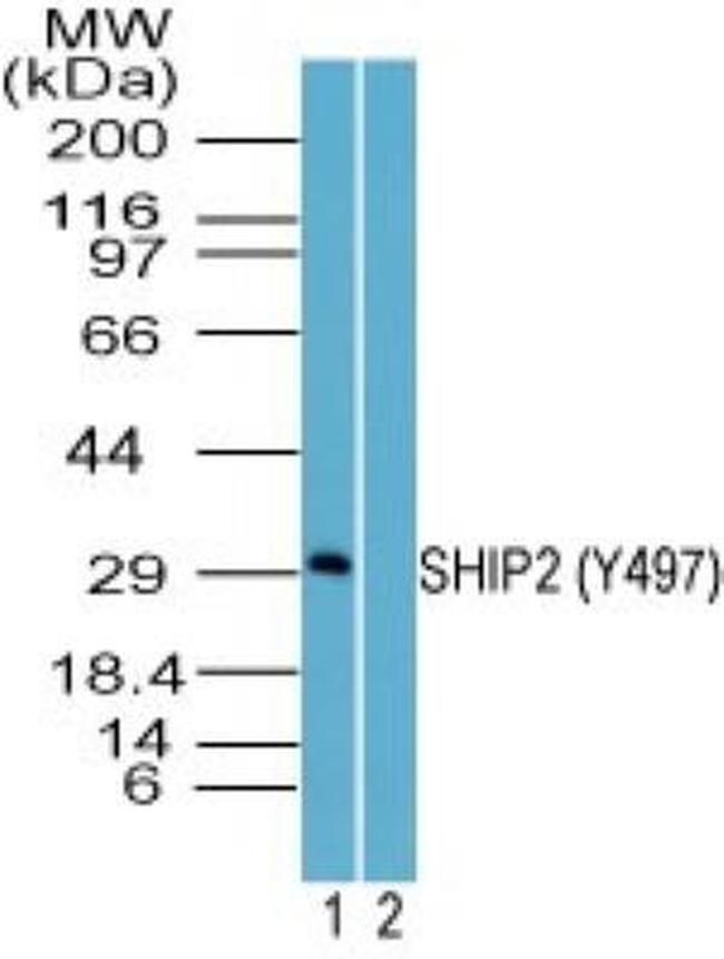 Phospho-SHIP2 (Tyr497) Antibody in Western Blot (WB)