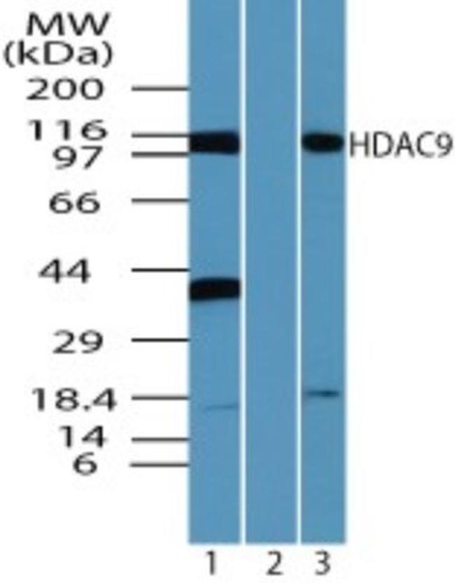 HDAC9 Antibody in Western Blot (WB)