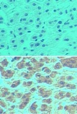 NALP11 Antibody in Immunohistochemistry (Paraffin) (IHC (P))