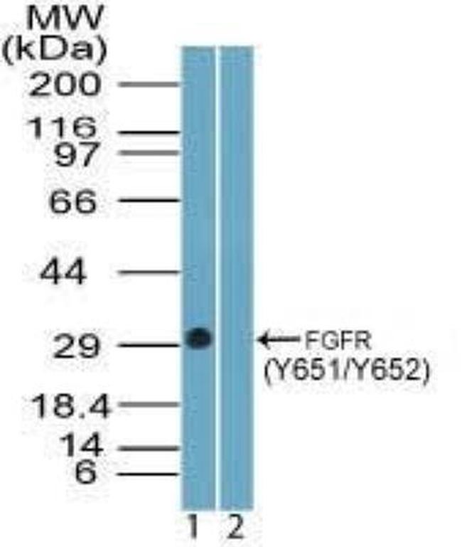 Phospho-FGFR1 (Tyr651, Tyr652) Antibody in Western Blot (WB)