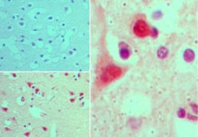 CENTG1 Antibody in Immunohistochemistry (Paraffin) (IHC (P))