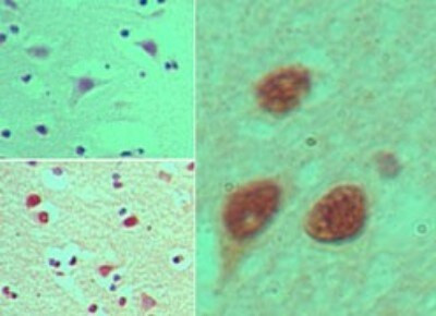 NUP35 Antibody in Immunohistochemistry (Paraffin) (IHC (P))