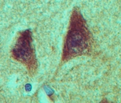 NANOS1 Antibody in Immunohistochemistry (Paraffin) (IHC (P))