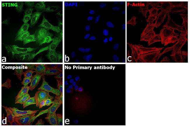 STING Antibody in Immunocytochemistry (ICC/IF)