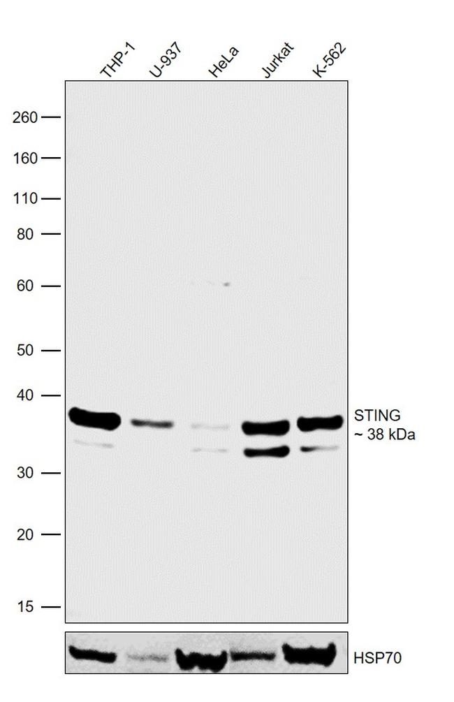 STING Antibody in Western Blot (WB)