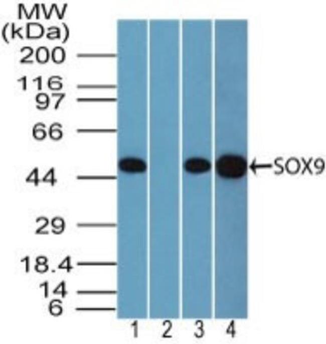 SOX9 Antibody in Western Blot (WB)