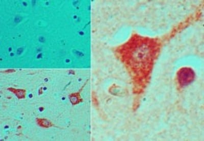 Nkx2.5 Antibody in Immunohistochemistry (Paraffin) (IHC (P))