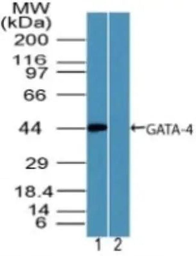 GATA4 Antibody in Western Blot (WB)