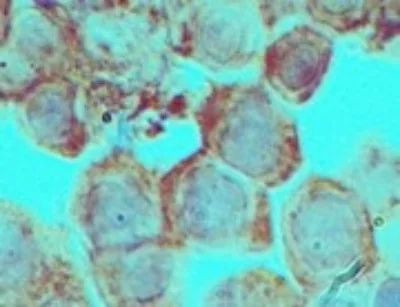 DLX3 Antibody in Immunohistochemistry (Paraffin) (IHC (P))