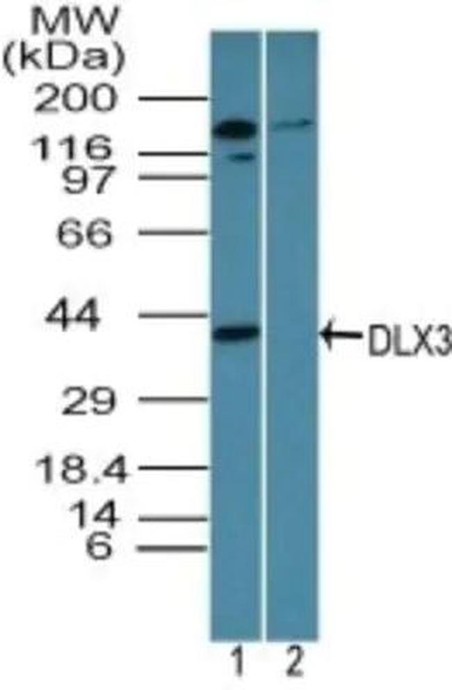 DLX3 Antibody in Western Blot (WB)