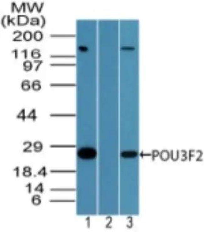 POU3F2 Antibody in Western Blot (WB)