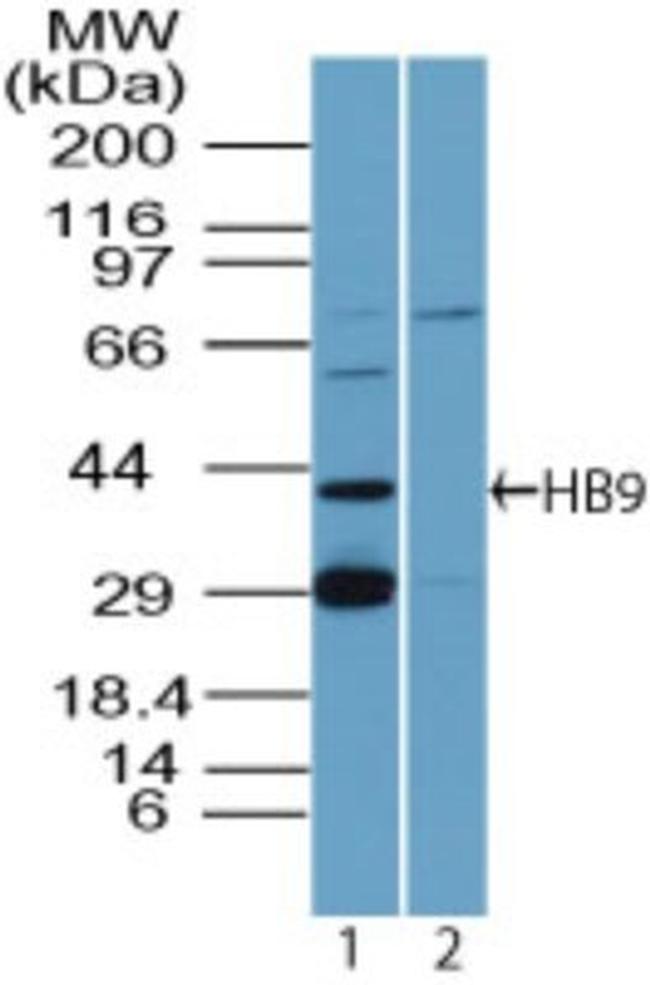 HB9 Antibody in Western Blot (WB)