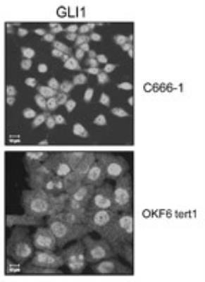 GLI1 Antibody in Immunocytochemistry (ICC/IF)