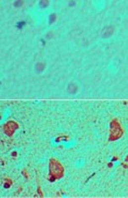 GLI1 Antibody in Immunohistochemistry (Paraffin) (IHC (P))