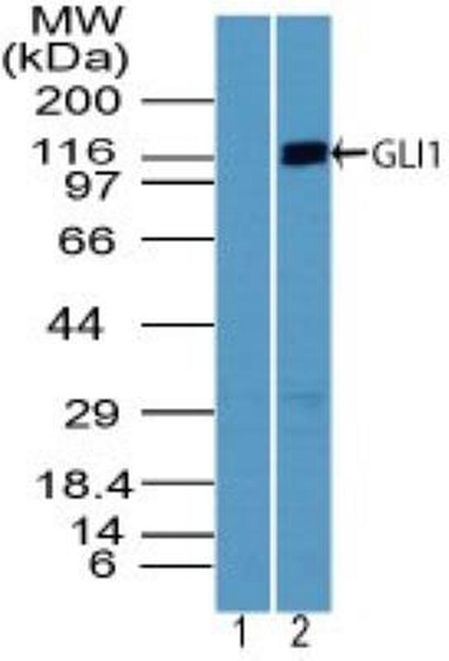 GLI1 Antibody in Western Blot (WB)