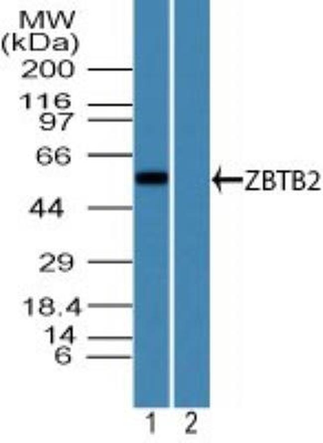 ZBTB2 Antibody in Western Blot (WB)