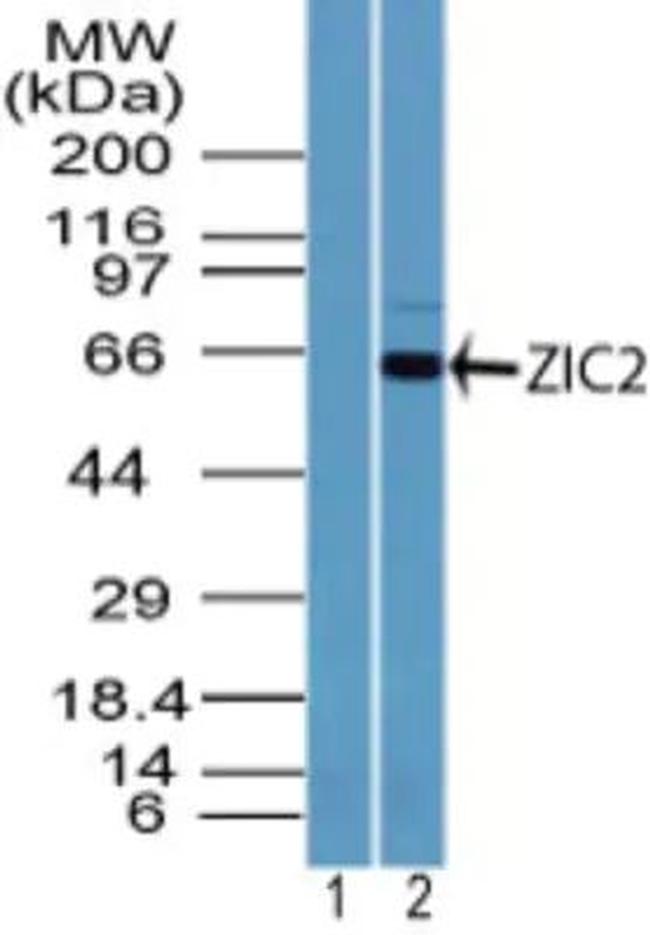 ZIC2 Antibody in Western Blot (WB)