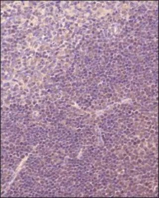 TRIF Antibody in Immunohistochemistry (Paraffin) (IHC (P))