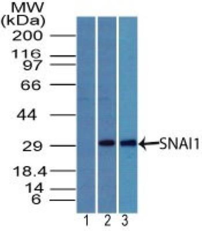 SNAIL Antibody in Western Blot (WB)