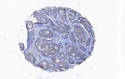 Coronin 3 Antibody in Immunohistochemistry (Paraffin) (IHC (P))