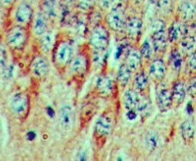 FGF20 Antibody in Immunohistochemistry (Paraffin) (IHC (P))