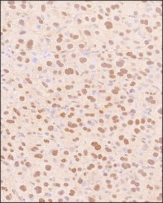 SNAIL Antibody in Immunohistochemistry (Paraffin) (IHC (P))