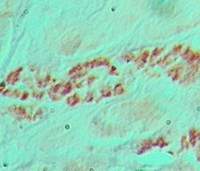 SNAIL Antibody in Immunohistochemistry (Paraffin) (IHC (P))