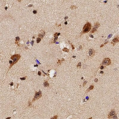 TLR7 Antibody in Immunohistochemistry (Paraffin) (IHC (P))