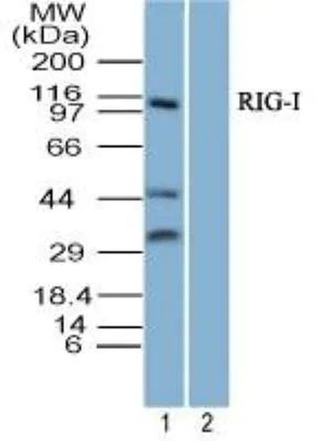 RIG-I Antibody in Western Blot (WB)