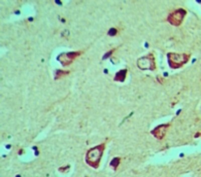 HES5 Antibody in Immunohistochemistry (Paraffin) (IHC (P))