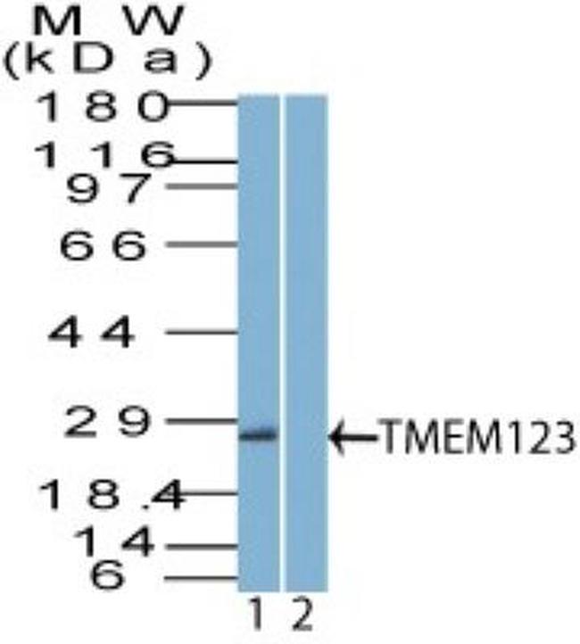 TMEM123 Antibody in Western Blot (WB)